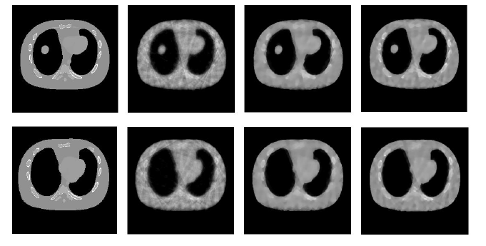  Fig. 2. Reconstruction results. The first row shows the image of phase 0 and the second row shows the image of phase 7. The firrst column is the ground truth. The second to the fourth column list the results reconstructed by standard ART, TVR[2] and our method. Only 20 iterations are used for all the method. 