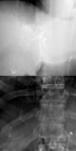 X-ray layers